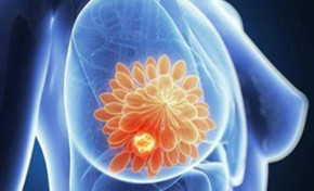 【大兴甲乳小课堂】乳腺癌距离我们有多远？——乳腺疾病健康教育系列（一)